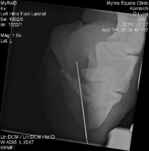 Luna Radiographs0007